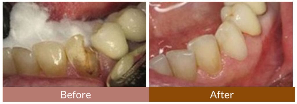 Before-After Smile Gallery